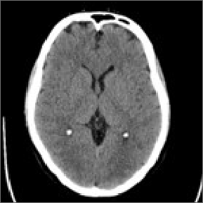 Image of guided DBS: collected images
